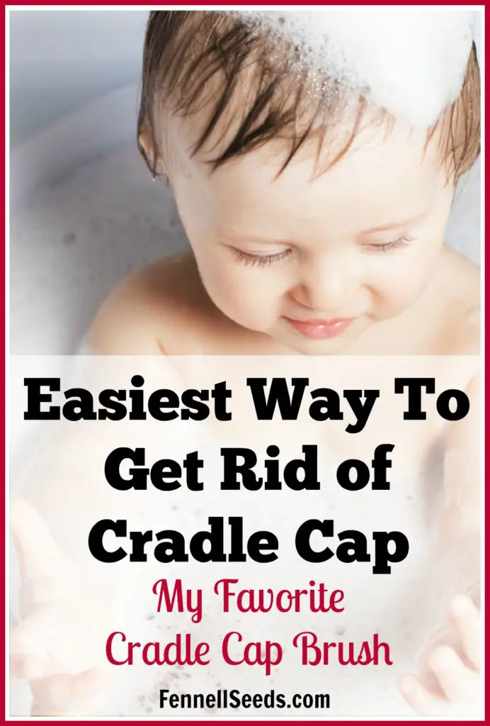 Cradle Cap | Cradle Cap Brush | How to get ride of Cradle Cap | My kids had terrible cradle cap. This cradle cap brush works awesome. I wasn't scared to use it on my baby because it has soft rounded rubber bristles. I used it every day for years.