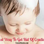 Easiest Way to Get Rid of Cradle Cap. My Favorite Cradle Cap Comb and Brush