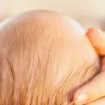 How To Prevent Flat Head Syndrome And Avoid the Baby Helmet